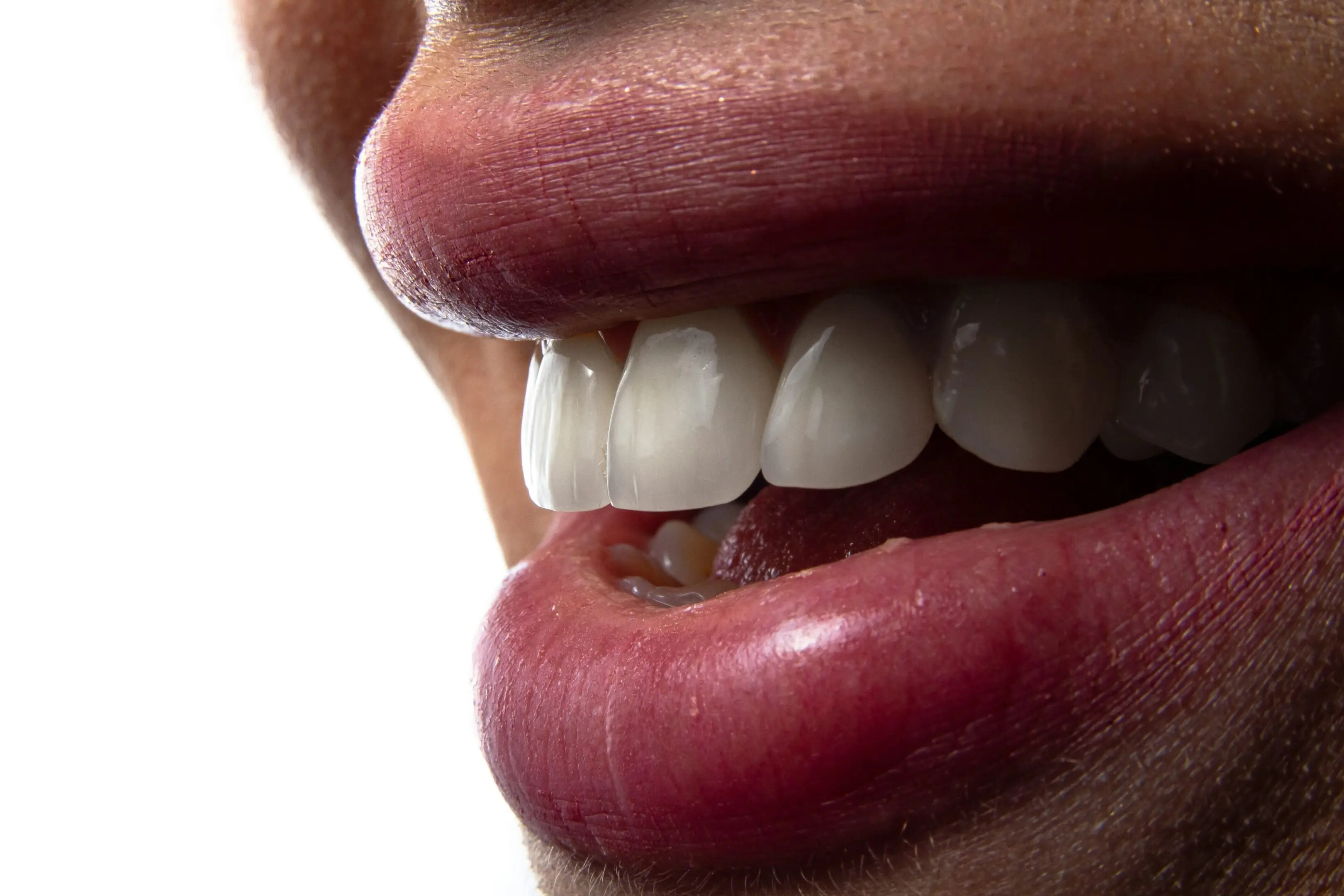 Close-up of a smile with bright teeth.